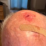 Red Badge of Courage